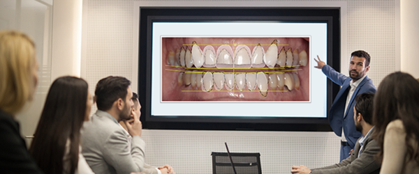People in Conference Room Looking at Full Set of Teeth on Video Monitor